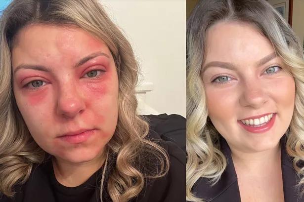 woman with red irritated skin questioning her skincare routine
