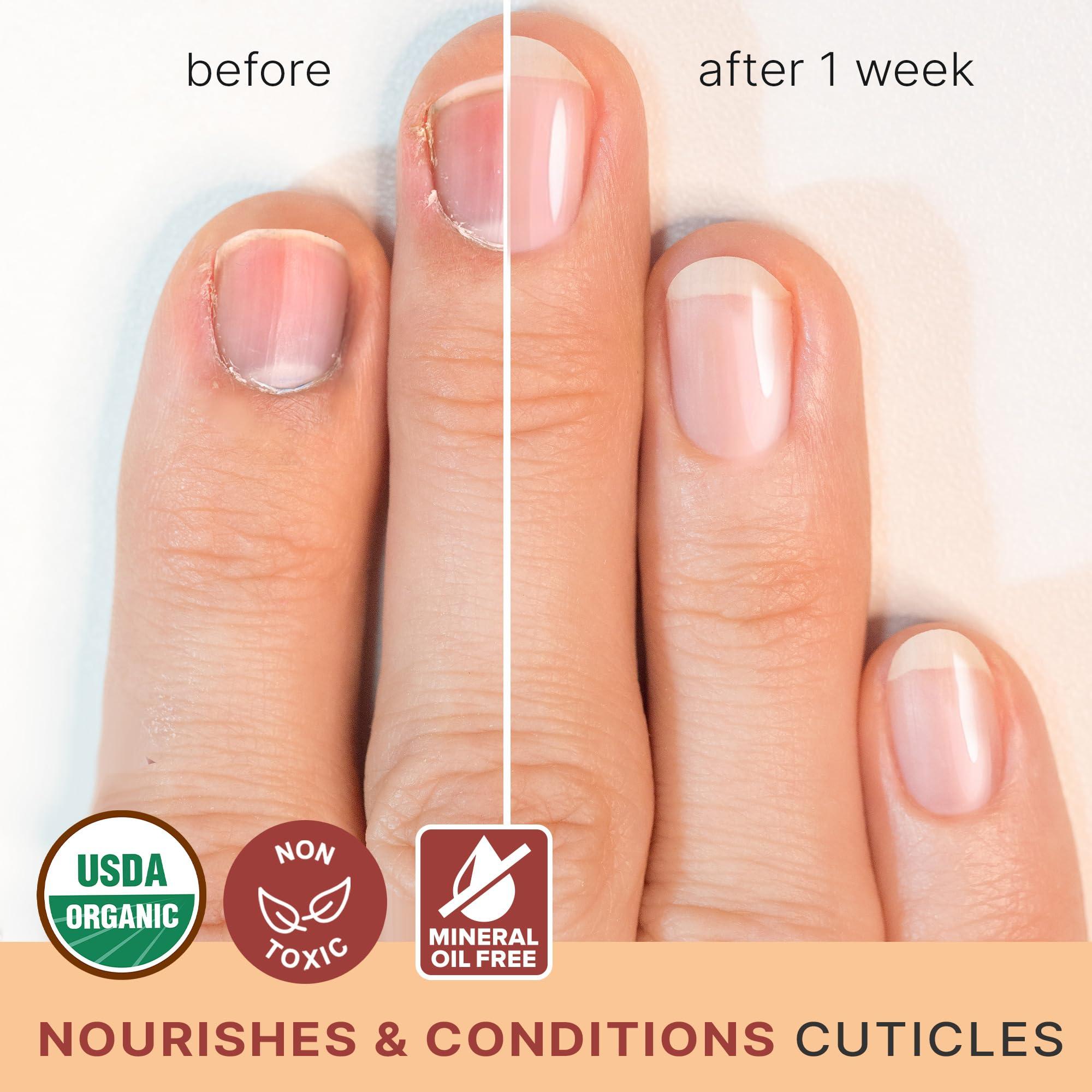 healthy nails with cuticle oil