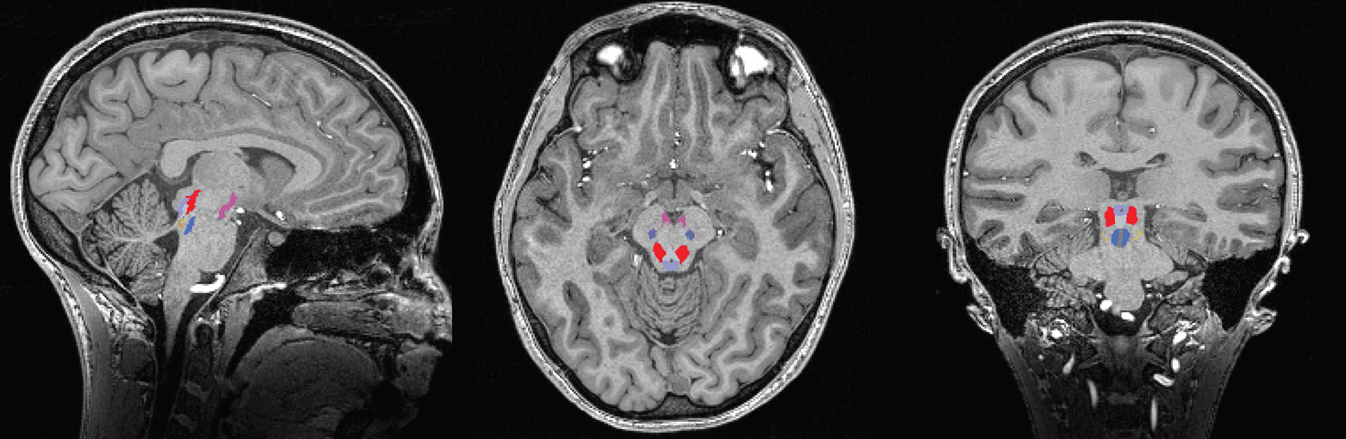 Brain image showing neuron activity during sleep