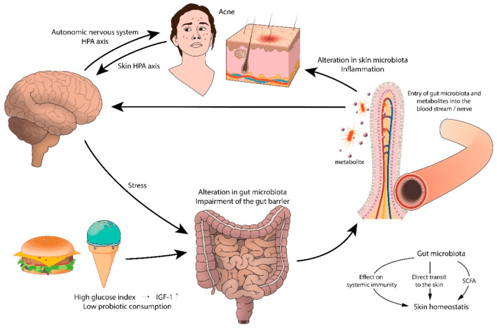 healthy gut and skin connection