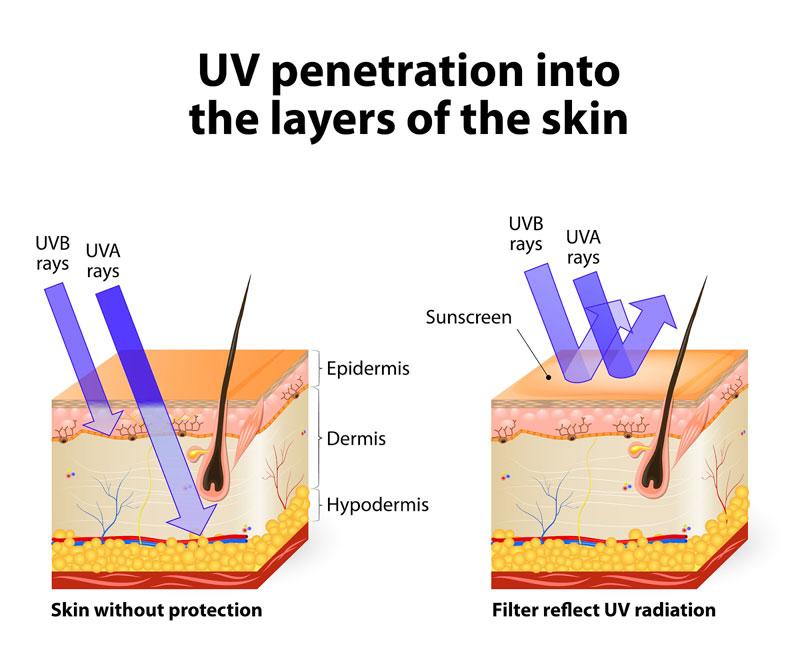 UV rays affecting skin