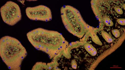 microscopic image of gut bacteria